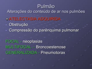 Pulmão Alterações do conteúdo de ar nos pulmões ATELECTASIA ADQUIRIDA Obstrução Compressão do parênquima pulmonar FOCAL -  neoplasias   MULTIFOCAL –  Broncoestenose GENERALIZADA -  Pneumotorax 