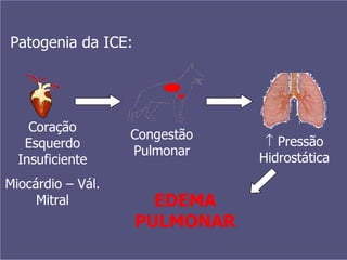 Patogenia da ICE: Coração Esquerdo Insuficiente Miocárdio – Vál. Mitral Congestão Pulmonar    Pressão Hidrostática EDEMA PULMONAR 
