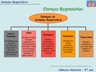 Sistema Respiratório

                                          Doenças Respiratórias
                                         Doenças do
                                     Sistema Respiratório




      Cancro              Asma
                                           Bronquite
     Pulmonar                                                   Pneumonia
                      Doença na qual                                           Tuberculose
                          Ocorrem              Doença
   As células que                           Inflamatória        Infecção do
                        Episódios de                                            Infecção
      revestem                             dos brônquios            tecido
                      Contracção dos                                           causada por
    os brônquios                          provocada por           pulmonar
                      brônquios. Pode                                          um bacilo que
    engrossam e                             substâncias         causada por,
                       ser provocada                                            destrói os
      aparecem                            irritantes, como      por exemplo,
                       por respostas                                             alvéolos.
   células atípicas                            o tabaco.          bactérias.
                        alérgicas ao
    nos alvéolos.
                      pólen, poeira, …




                                                             Ciências Naturais – 9º ano
 
