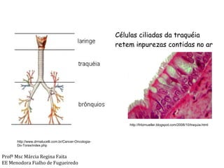 http://www.drmalucelli.com.br/Cancer-Oncologia-Do-Torax/index.php Células ciliadas da traquéia retem inpurezas contidas no ar http://fritzmueller.blogspot.com/2008/10/traquia.html Profª Msc Márcia Regina Faita EE Menodora Fialho de Fugueiredo 