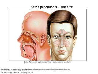 http://www.auladeanatomia.com/respiratorio/sistemarespiratorio.htm Seios paranasais - sinosite Profª Msc Márcia Regina Faita EE Menodora Fialho de Fugueiredo 