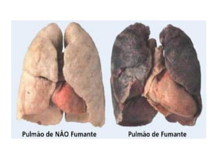 Sistema respiratório_Lidiane