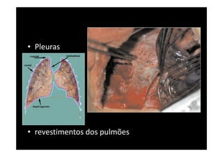 Hematose nos tecidos
19
 