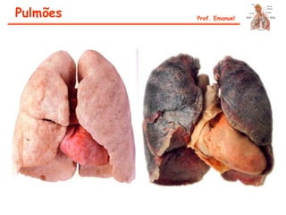 Pulmões Prof. Emanuel
 