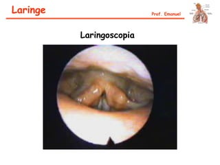 Laringe Prof. Emanuel
Laringoscopia
 