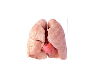 Sistema respiratório