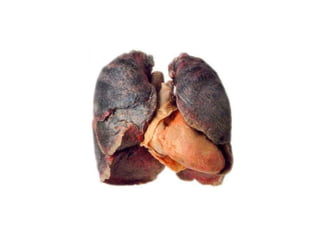 Sistema respiratório