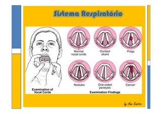 Sistema Respiratório
by Ana Kastroby Ana Kastro
 