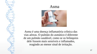 17
Asma
Asma é uma doença inflamatória crônica das
vias aéreas. O pulmão do asmático é diferente
de um pulmão saudável, como se os brônquios
dele fossem mais sensíveis e inflamados,
reagindo ao menor sinal de irritação.
 