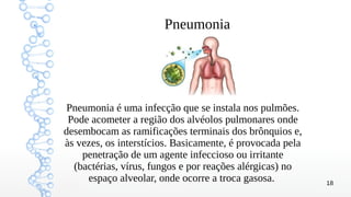 18
Pneumonia
Pneumonia é uma infecção que se instala nos pulmões.
Pode acometer a região dos alvéolos pulmonares onde
desembocam as ramificações terminais dos brônquios e,
às vezes, os interstícios. Basicamente, é provocada pela
penetração de um agente infeccioso ou irritante
(bactérias, vírus, fungos e por reações alérgicas) no
espaço alveolar, onde ocorre a troca gasosa.
 