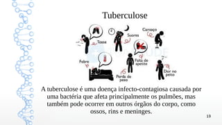 19
Tuberculose
A tuberculose é uma doença infecto-contagiosa causada por
uma bactéria que afeta principalmente os pulmões, mas
também pode ocorrer em outros órgãos do corpo, como
ossos, rins e meninges.
 