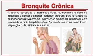 A doença associada a morbidade física, aumentando o risco de
infecções e câncer pulmonar, podendo progredir para uma doença
pulmonar obstrutiva crônica. A presença crônica da inflamação esta
associada a mais hospitalizações. Apresenta sintomas como tosse,
respiração curta, sibilancia, cianose.
 