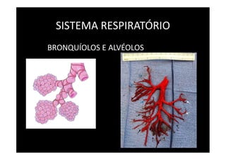 SISTEMA RESPIRATÓRIO
BRONQUÍOLOS E ALVÉOLOS
 
