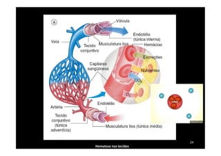 Hematose nos tecidos
24
 