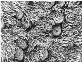 célula caliciforme
 
