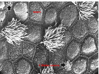 muco
Células escova
 