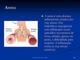  A asma é uma doença
inflamatória crônica das
vias aéreas. Em
indivíduos susceptíveis
esta inflamação causa
episódios recorrentes de
tosse, chiado, aperto no
peito, e dificuldade para
respirar. A inflamação
torna as vias aéreas
sensíveis.
Ciências Naturais - ICRM 24
 