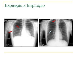 Expiração x Inspiração 