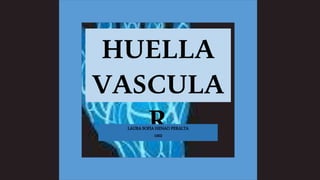 HUELLA
VASCULA
RLAURA SOFIA HENAO PERALTA
1002
 