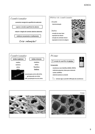 4/24/11	
  
9	
  
Condicionador!
	
  	
  	
  	
  	
  	
  aumentar	
  energia	
  de	
  superBcie	
  do	
  aderente	
  
superar	
  a	
  tensão	
  superﬁcial	
  do	
  adesivo	
  
	
  	
  	
  	
  	
  reduzir	
  o	
  ângulo	
  de	
  contato	
  adesivo-­‐aderente	
  
melhorar	
  escoamento	
  e	
  molhamento	
  	
  
Criar retenção!!
Efeitos do condicionador!
Esmalte!
Dentina!
desmineralização	
  
remoção	
  da	
  smear	
  layer	
  
exposição	
  dos	
  túbulos	
  
remoção	
  de	
  conteúdo	
  mineral	
  
exposição	
  da	
  matriz	
  de	
  colágeno	
  
Condicionador!
ácidos	
  orgânicos	
   ácidos	
  minerais	
  
maléico	
  
tartárico	
  
cítrico	
  
EDTA	
  
clorídrico	
  
nítrico	
  
ﬂuorídrico	
  
fosfórico	
  
concentrações	
  de	
  20	
  a	
  40%	
  (37%)	
  
gel	
  (espessado	
  com	
  sílica)	
  
>	
  40%:	
  precipitação	
  de	
  sais	
  de	
  cálcio	
  
Primer!
energia	
  de	
  superBcie	
  da	
  den^na	
  
Composição	
  
monômeros	
  mais	
  hidróﬁlos	
  (HEMA,	
  PENTA)	
  
moléculas	
  pequenas,	
  baixo	
  peso	
  molecular	
  
caráter	
  ambiBlico	
  
solvente	
  (acetona	
  ou	
  etanol)	
  
	
  
remover	
  água	
  e	
  permi^r	
  inﬁltração	
  dos	
  monômeros	
  
Perdigão !
 