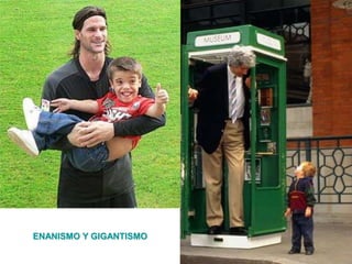 ENANISMO Y GIGANTISMO
 