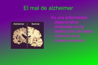 Alteraciones en el sistema nervioso 