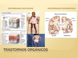 ENFERMIDADES INFECCIOSAS   ENFERMIDADES DEXENERATIVAS

                     polio




                     polio




TRASTORNOS ORGÁNICOS
 