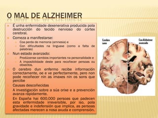 O MAL DE ALZHEIMER
   É unha enfermidade dexenerativa producida pola
    destrucción do tecido nervioso do cortex
    cerebral.
   Comeza a manifestarse:
        Coa perda de memoria (amnesia) e
        Con dificultades na linguaxe (como a falta de
         palabras)
   Nun estado avanzado:
        Prodúcense cambios importantes na personalidade e
        A imposibilidade deste para recoñecer persoas ou
         obxectos.
   O cerebro dun enfermo recibe información
    correctamente, oe e ve perfectamente, pero non
    pode recoñecer nin as imaxes nin os sons que
    percibe
   Causas descoñecidas
   A investigación sobre a súa orixe e a prevención
    avanza rápidamente.
   En España hai 600.000 persoas que padecen
    esta enfermidade irreversible, por iso, pola
    gravidade e indefensión que implica, as persoas
    afectadas merecen a nosa axuda e comprensión.
 