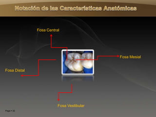 Page  32
Fosa Central
Fosa Distal
Fosa Mesial
Fosa Vestibular
 