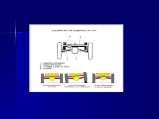 Sistemas de suspención