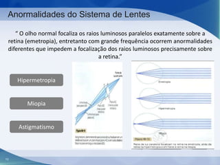 Anormalidades do Sistema de Lentes
“ O olho normal focaliza os raios luminosos paralelos exatamente sobre a
retina (emetropia), entretanto com grande frequência ocorrem anormalidades
diferentes que impedem a focalização dos raios luminosos precisamente sobre
a retina.”

Hipermetropia

Miopia

Astigmatismo

13

 