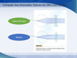 Correção das Anomalias Ópticas do Olho com Óculos

Hipermetropia

Miopia

14

 