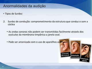 Anormalidades da audição
• Tipos de Surdez:
2. Surdez de condução: comprometimento da estrutura que conduz o som a
cóclea
• As ondas sonoras não podem ser transmitidas facilmente através dos
ossículos da membrana timpânica a janela oval.
• Pode ser amenizada com o uso de aparelhos auditivos

57

 