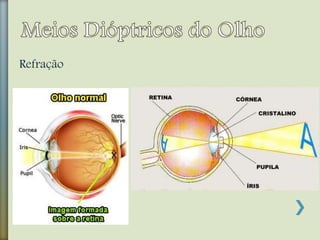 Refração
 