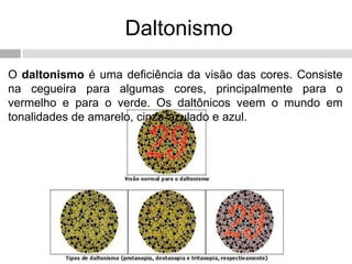 Daltonismo
O daltonismo é uma deficiência da visão das cores. Consiste
na cegueira para algumas cores, principalmente para o
vermelho e para o verde. Os daltônicos veem o mundo em
tonalidades de amarelo, cinza-azulado e azul.
 
