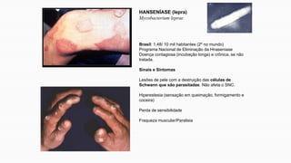 HANSENÍASE (lepra)
Mycobacterium leprae
Brasil: 1,48/ 10 mil habitantes (2º no mundo)
Programa Nacional de Eliminação da Hnaseniase
Doença contagiosa (incubação longa) e crônica, se não
tratada.
Sinais e Sintomas
Lesões de pele com a destruição das células de
Schwann que são parasitadas. Não afeta o SNC.
Hiperestesia (sensação em queimação, formigamento e
coceira)
Perda de sensibilidade
Fraqueza muscular/Paralisia
 