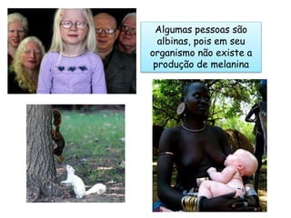 Algumas pessoas são
albinas, pois em seu
organismo não existe a
produção de melanina
 