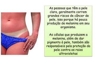 As pessoas que têm a pele
clara, geralmente correm
grandes riscos de câncer de
pele, isso porque há pouca
produção de melanina em seu
organismo.
As células que produzem a
melanina, além de dar
pigmento à pele, também são
responsáveis pela proteção da
pele contra os raios
ultravioletas
 
