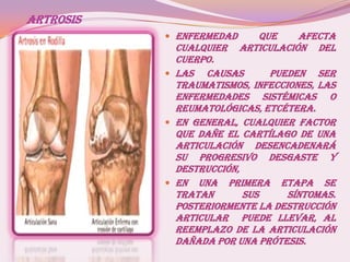 ARTROSIS
 Enfermedad que afecta
cualquier articulación del
cuerpo.
 LAS causas pueDEN SER
traumatismos, infecciones, las
enfermedades sistémicas o
reumatológicas, etcétera.
 En general, cualquier factor
que dañe el cartílago de una
articulación desencadenará
su progresivo desgaste y
destrucción,
 En una primera etapa se
tratan sus síntomas.
Posteriormente la destrucción
articular puede llevar, al
reemplazo de la articulación
dañada por una Prótesis.
 