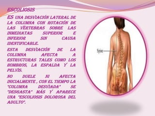 ESCOLIOSIS
Es una desviación lateral de
la columna con rotación de
las vértebras sobre las
inmediatas superior e
inferior sin causa
identificable.
Esta desviación de la
columna afecta a
estructuras tales como los
hombros, la espalda y la
pelvis.
No duele ni afecta
inicialmente , con el tiempo LA
"columna desviada" se
"desgasta" más y aparece
una "escoliosis dolorosa del
adulto".
 