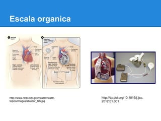 Escala organica




http://www.nhlbi.nih.gov/health/health-   http://dx.doi.org/10.1016/j.jjcc.
topics/images/abiocor_tah.jpg             2012.01.001
 