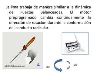 La lima trabaja de manera similar a la dinámica
de Fuerzas Balanceadas. El motor
preprogramado cambia continuamente la
dirección de rotación durante la conformación
del conducto radicular.
170º
30º
 