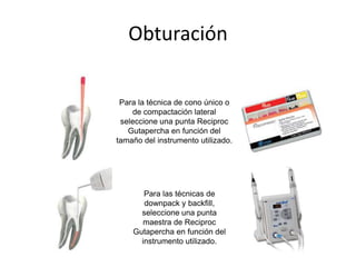 Obturación
Para la técnica de cono único o
de compactación lateral
seleccione una punta Reciproc
Gutapercha en función del
tamaño del instrumento utilizado.
Para las técnicas de
downpack y backfill,
seleccione una punta
maestra de Reciproc
Gutapercha en función del
instrumento utilizado.
 