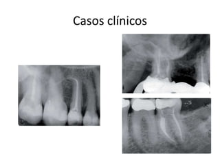 Casos clínicos
 