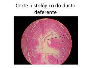 Corte histológico do ducto
        deferente
 