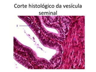 Corte histológico da vesícula
          seminal
 