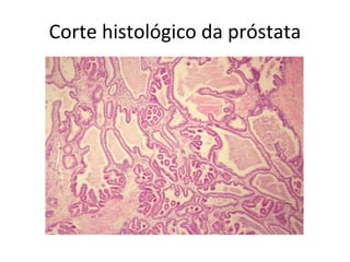 Corte histológico da próstata
 