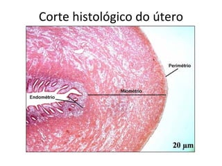 Corte histológico do útero
 