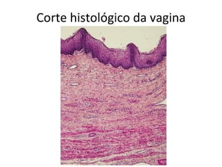 Corte histológico da vagina
 