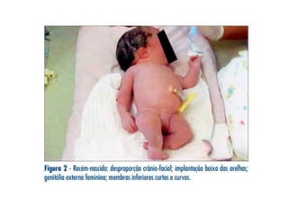 Sistemas reprodutores